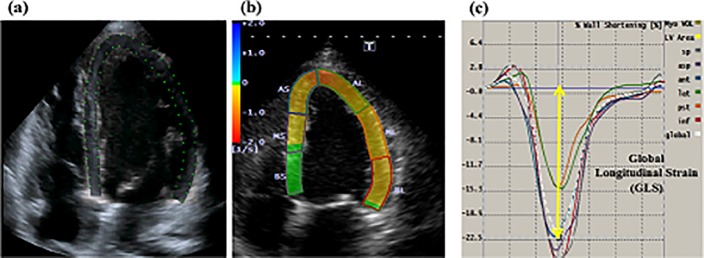 Fig 2