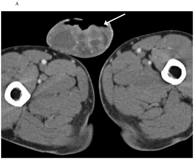 Figure 12.
