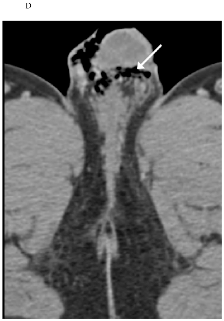 Figure 13.