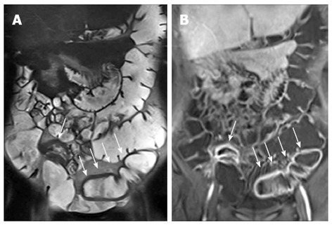 Figure 22