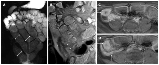 Figure 18