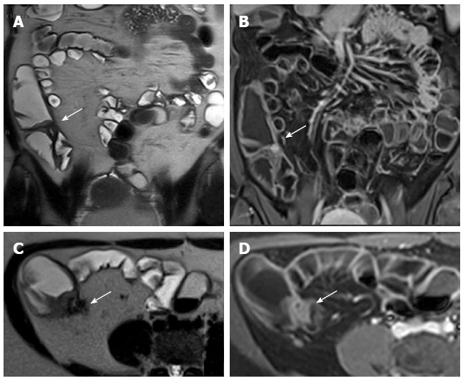 Figure 19