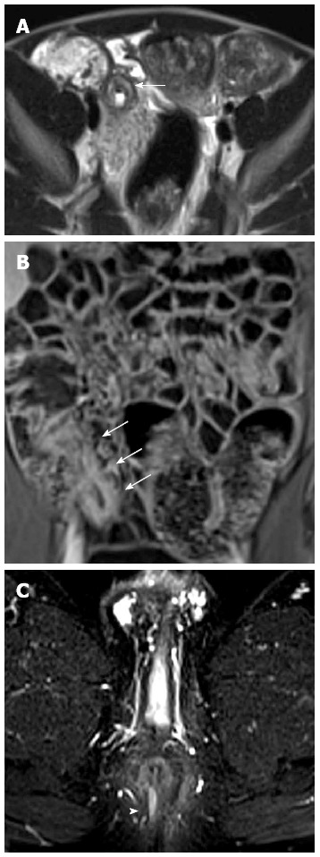 Figure 21