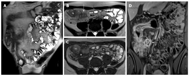 Figure 17