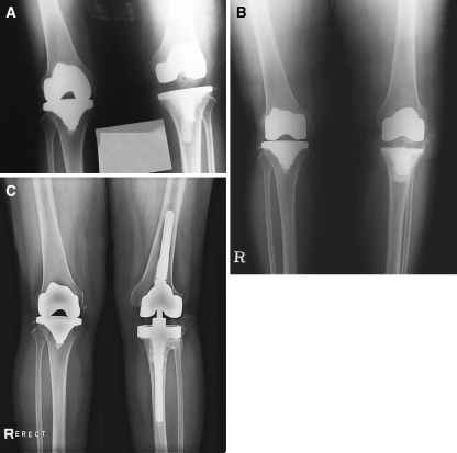 Fig. 1A–C