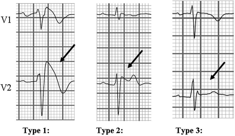 Figure 3.