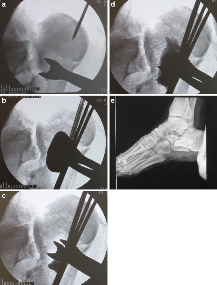 Fig. 1