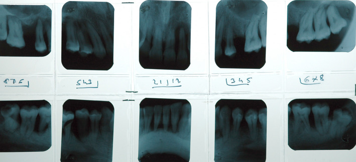 FIGURE 2