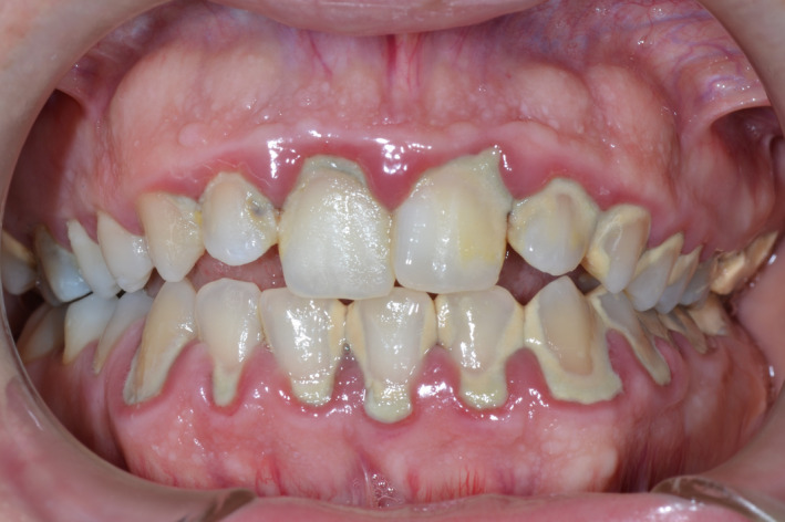 FIGURE 3