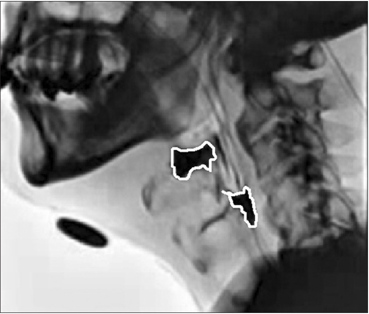 Fig. 3.