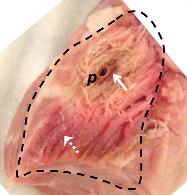 Figure 2b: