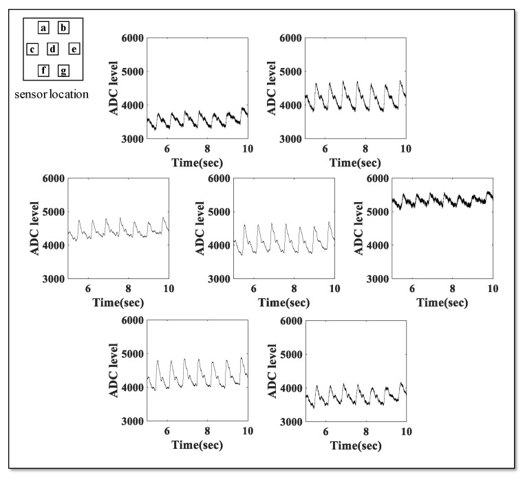 Figure 11