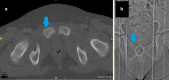 Fig. 20