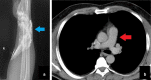 Fig. 15