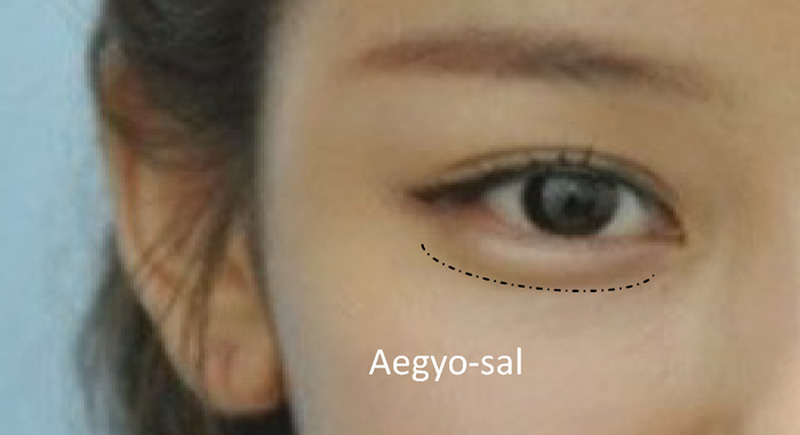 Fig. 11