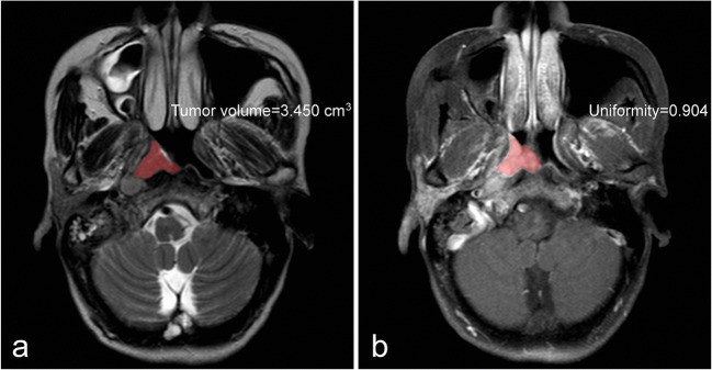 Fig. 3