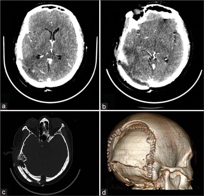 Figure 2: