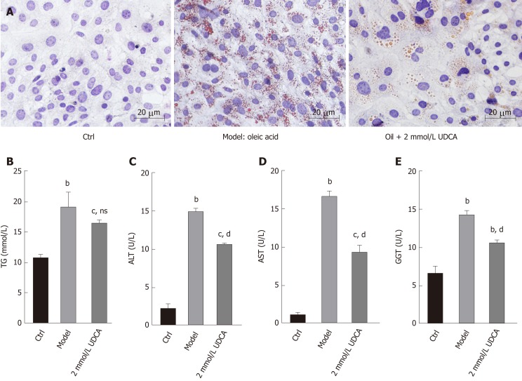 Ursodeoxycholic acid ameliorates hepatic lipid metabolism in LO2 cells ...