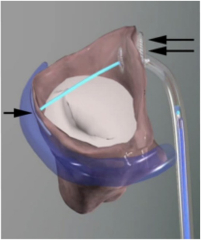 Figure 4