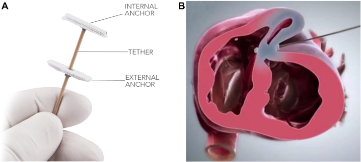 Figure 6