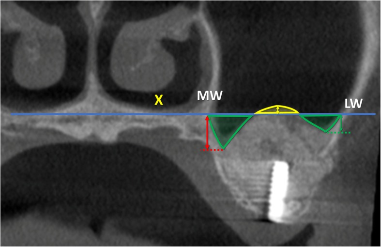 Fig. 4