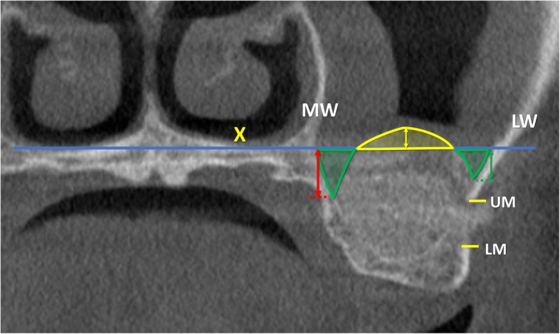 Fig. 3