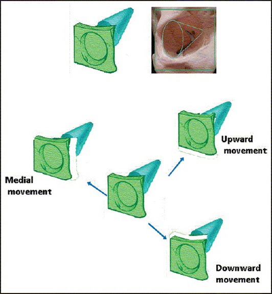 Figure 5