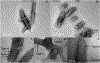 Fig. 16.