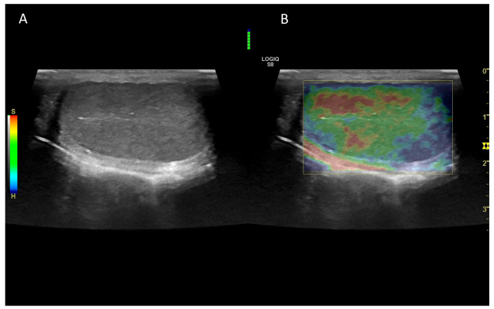 Figure 10