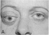 210