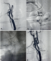 Figure 1. a-d