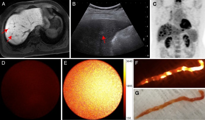 Figure 3: