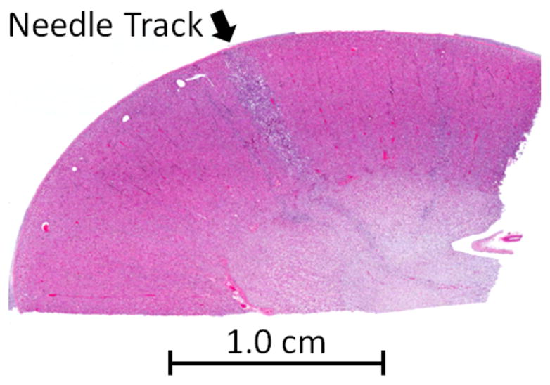 Fig. 12