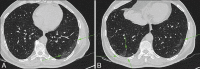 Figure 1 (A and B)