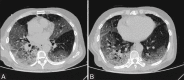 Figure 4 (A and B)