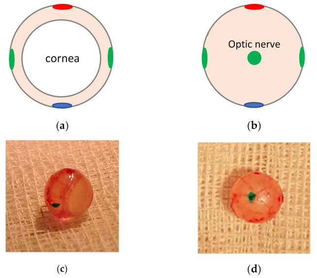 Figure 14