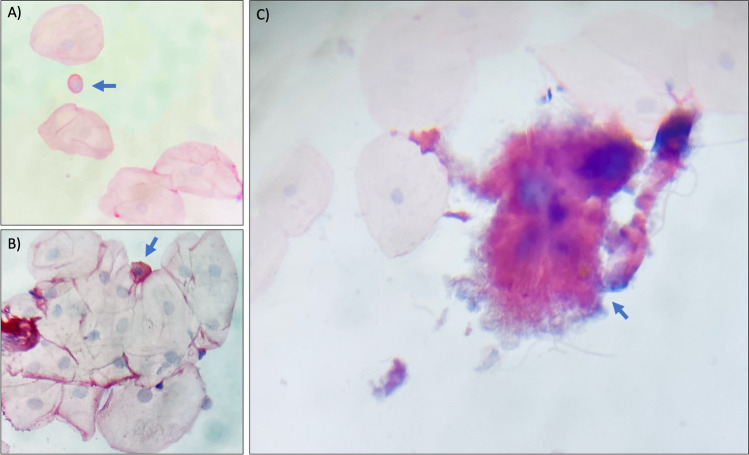 Fig. 2