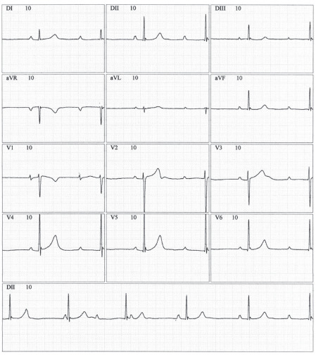 Fig. (7)