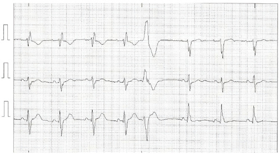 Fig. (5)