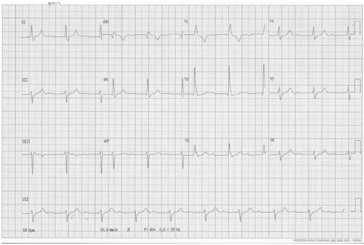 Fig. (4)