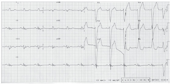 Fig. (3)