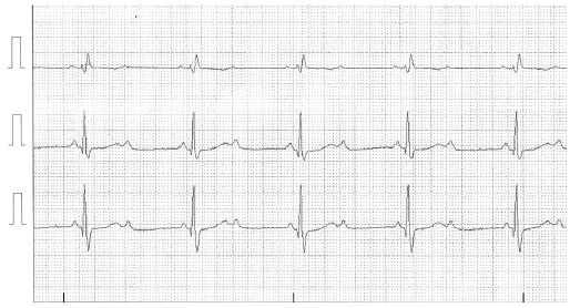 Fig. (6)