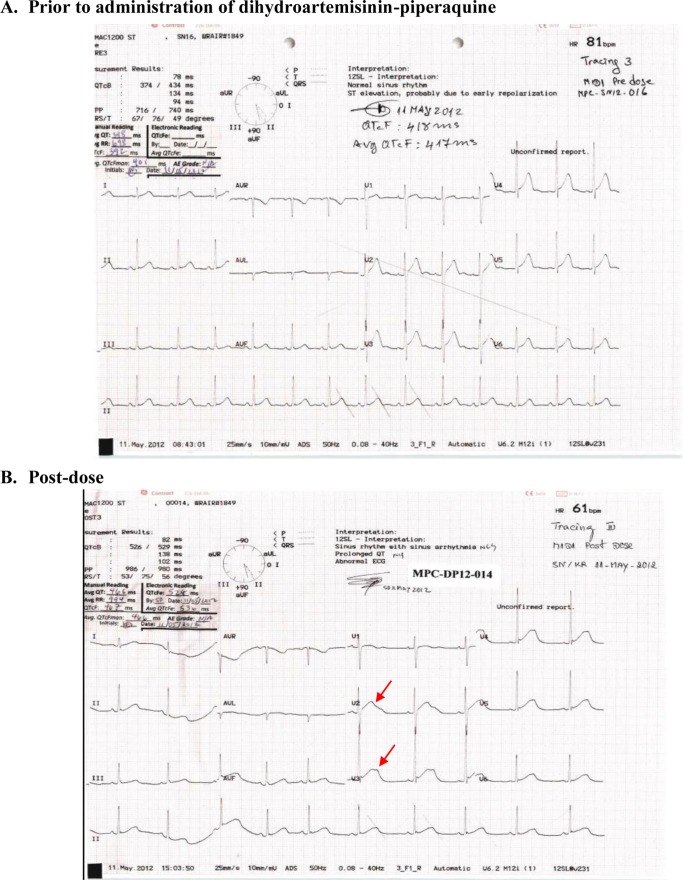 FIG 2