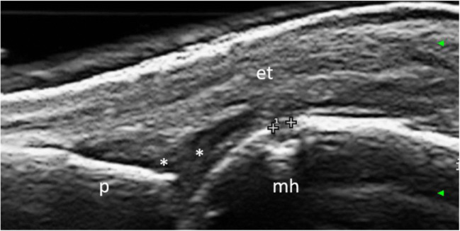 Fig. 2