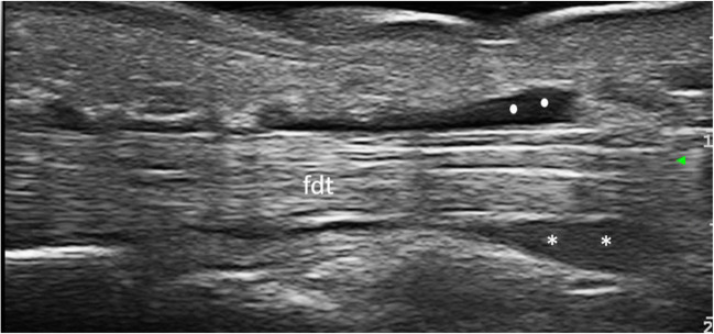 Fig. 1