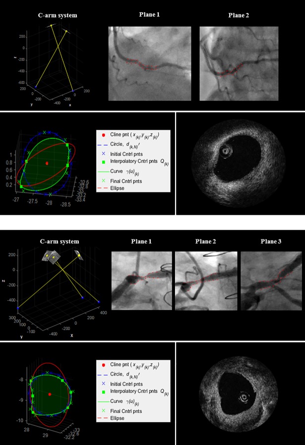 Fig 10