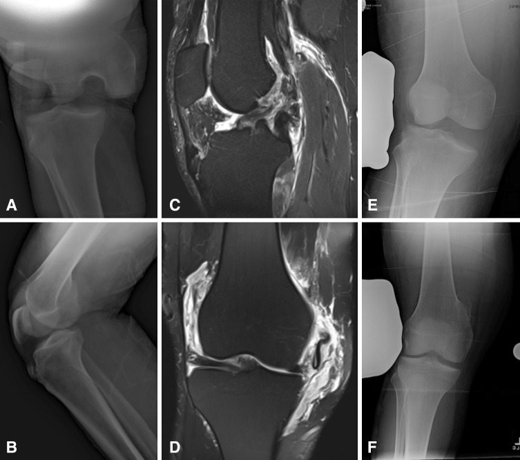 Fig. 1A–F