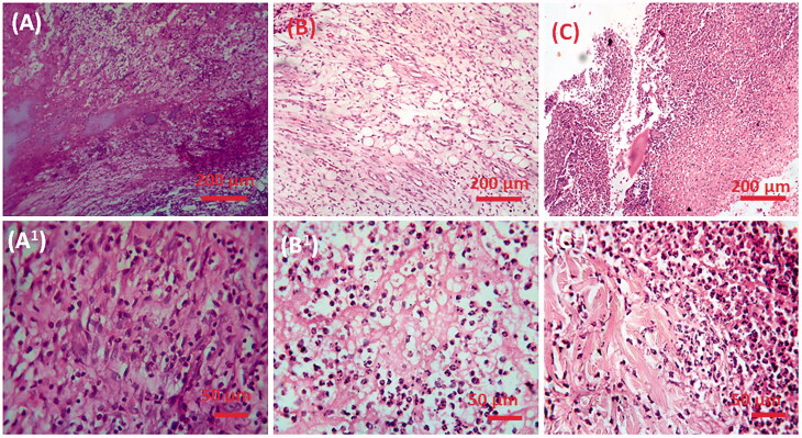 Figure 11.