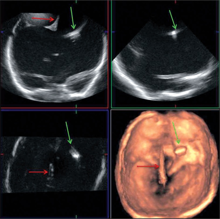 Fig. 4