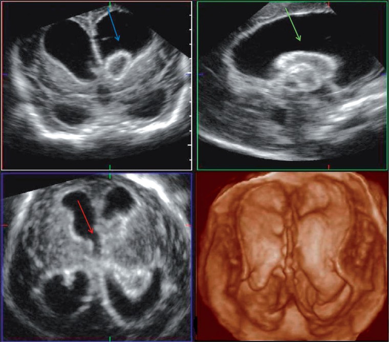 Fig. 3